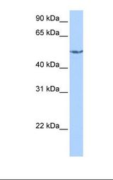 CRAT Antibody - HepG2 cell lysate. Antibody concentration: 1.0 ug/ml. Gel concentration: 12%.  This image was taken for the unconjugated form of this product. Other forms have not been tested.