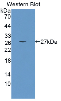 CRAT Antibody - Western blot of CRAT antibody.