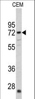 CRAT Antibody - Western blot of CRAT antibody in CEM cell line lysates (35 ug/lane). CRAT (arrow) was detected using the purified antibody.