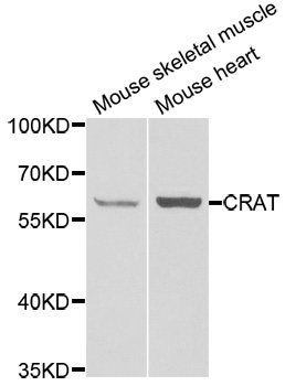 CRAT Antibody - Western blot analysis of extracts of various cell lines.
