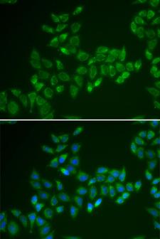 CRAT Antibody - Immunofluorescence analysis of HeLa cells.