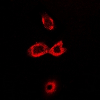 CRAT Antibody - Immunofluorescent analysis of CAT1 staining in HeLa cells. Formalin-fixed cells were permeabilized with 0.1% Triton X-100 in TBS for 5-10 minutes and blocked with 3% BSA-PBS for 30 minutes at room temperature. Cells were probed with the primary antibody in 3% BSA-PBS and incubated overnight at 4 deg C in a humidified chamber. Cells were washed with PBST and incubated with a DyLight 594-conjugated secondary antibody (red) in PBS at room temperature in the dark.