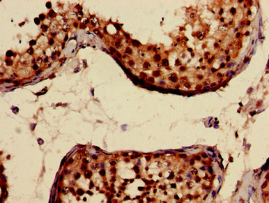 CRAT Antibody - Immunohistochemistry image of paraffin-embedded human testis tissue at a dilution of 1:100