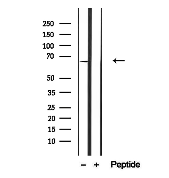 CRAT Antibody - Western blot analysis of extracts of mouse skeletal muscle tissue using Crat antibody.