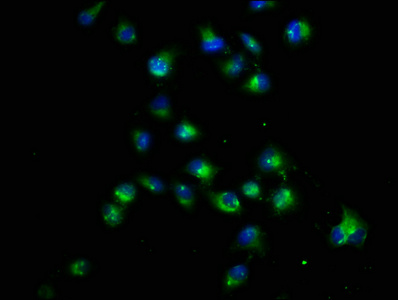 CRB1 Antibody - Immunofluorescence staining of Hela cells with CRB1 Antibody at 1:22, counter-stained with DAPI. The cells were fixed in 4% formaldehyde, permeabilized using 0.2% Triton X-100 and blocked in 10% normal Goat Serum. The cells were then incubated with the antibody overnight at 4°C. The secondary antibody was Alexa Fluor 488-congugated AffiniPure Goat Anti-Rabbit IgG(H+L).