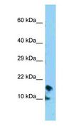 CRB3 Antibody - CRB3 antibody Western Blot of HepG2.  This image was taken for the unconjugated form of this product. Other forms have not been tested.
