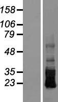 CRB3 Protein - Western validation with an anti-DDK antibody * L: Control HEK293 lysate R: Over-expression lysate