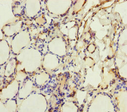 CRBN / Cereblon Antibody - Immunohistochemistry of paraffin-embedded human thyroid tissue at dilution of 1:100