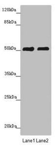 CRBN / Cereblon Antibody - Western blot All Lanes: CRBN antibody at 5.28 ug/ml Lane 1: Mouse liver tissue Lane 2: A375 whole cell lysate Secondary Goat polyclonal to rabbit IgG at 1/10000 dilution Predicted band size: 51 kDa Observed band size: 51 kDa