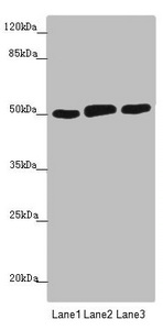 CRBN / Cereblon Antibody - Western blot All Lanes: CRBN antibody at 4.65 ug/ml Lane 1: Mouse liver tissue Lane 2: Colo320 whole cell lysate Lane 3: A375 whole cell lysate Secondary Goat polyclonal to rabbit IgG at 1/10000 dilution Predicted band size: 51 kDa Observed band size: 51 kDa