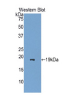 CRBPIV / RBP7 Antibody - Western blot of recombinant CRBPIV / RBP7.