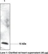 CRBPIV / RBP7 Antibody - Western blot of CRBPIV / RBP7 antibody.