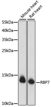 CRBPIV / RBP7 Antibody - Western blot analysis of extracts of various cell lines using RBP7 Polyclonal Antibody at dilution of 1:1000.