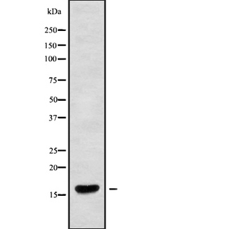 CRCP / CGRP Receptor Component Antibody - Western blot analysis of RPC9 using HuvEc whole cells lysates