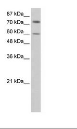 CRD-BP / ZBP1 / IGF2BP1 Antibody - HepG2 Cell Lysate.  This image was taken for the unconjugated form of this product. Other forms have not been tested.