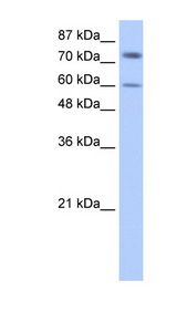 CRD-BP / ZBP1 / IGF2BP1 Antibody - IGF2BP1 antibody Western blot of HepG2 cell lysate. This image was taken for the unconjugated form of this product. Other forms have not been tested.