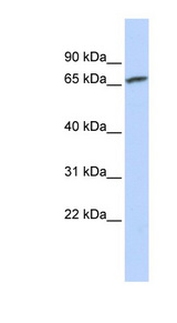 CRD-BP / ZBP1 / IGF2BP1 Antibody - IGF2BP1 antibody Western blot of Jurkat lysate. This image was taken for the unconjugated form of this product. Other forms have not been tested.