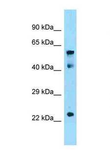 CRD-BP / ZBP1 / IGF2BP1 Antibody - IGF2BP1 antibody Western blot of Mouse Thymus lysate. Antibody concentration 1 ug/ml.  This image was taken for the unconjugated form of this product. Other forms have not been tested.