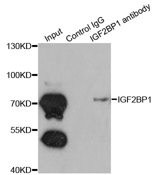 CRD-BP / ZBP1 / IGF2BP1 Antibody - Immunoprecipitation analysis of 200ug extracts of K562 cells.