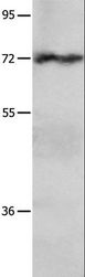 CRD-BP / ZBP1 / IGF2BP1 Antibody - Western blot analysis of HeLa cell, using IGF2BP1 Polyclonal Antibody at dilution of 1:750.