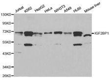 CRD-BP / ZBP1 / IGF2BP1 Antibody - Western blot analysis of extracts of various cell lines, using IGF2BP1 antibody at 1:1000 dilution. The secondary antibody used was an HRP Goat Anti-Rabbit IgG (H+L) at 1:10000 dilution. Lysates were loaded 25ug per lane and 3% nonfat dry milk in TBST was used for blocking.