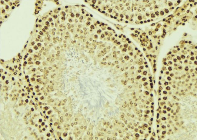 CRD-BP / ZBP1 / IGF2BP1 Antibody - 1:100 staining mouse testis tissue by IHC-P. The sample was formaldehyde fixed and a heat mediated antigen retrieval step in citrate buffer was performed. The sample was then blocked and incubated with the antibody for 1.5 hours at 22°C. An HRP conjugated goat anti-rabbit antibody was used as the secondary.