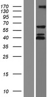 CRD-BP / ZBP1 / IGF2BP1 Protein - Western validation with an anti-DDK antibody * L: Control HEK293 lysate R: Over-expression lysate