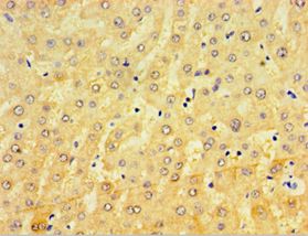 CRD / CRX Antibody - Immunohistochemistry of paraffin-embedded human liver using antibody at 1:100 dilution.