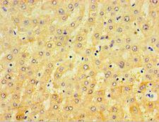 CRD / CRX Antibody - Immunohistochemistry of paraffin-embedded human liver using antibody at 1:100 dilution.
