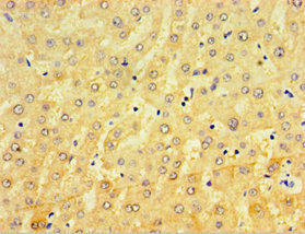CRD / CRX Antibody - Immunohistochemistry of paraffin-embedded human liver tissue using CRX Antibody at dilution of 1:100