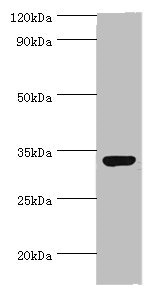 CRD / CRX Antibody - Western blot All lanes: CRX antibody at 2µg/ml + 293T whole cell lysate Secondary Goat polyclonal to rabbit IgG at 1/10000 dilution Predicted band size: 32 kDa Observed band size: 32 kDa