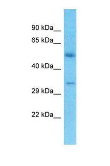 CRD / CRX Antibody - Western blot of Human Thymus Tumor. CRX antibody dilution 1.0 ug/ml.  This image was taken for the unconjugated form of this product. Other forms have not been tested.