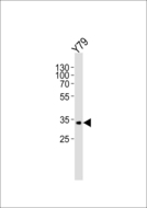 CRD / CRX Antibody - Western blot of lysate from Y79 cell line with CRX Antibody. Antibody was diluted at 1:1000. A goat anti-rabbit IgG H&L (HRP) at 1:5000 dilution was used as the secondary antibody. Lysate at 35 ug.