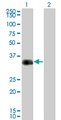 CRD / CRX Antibody - Western Blot analysis of CRX expression in transfected 293T cell line by CRX monoclonal antibody (M01), clone F6-C2.Lane 1: CRX transfected lysate(32.261 KDa).Lane 2: Non-transfected lysate.