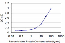 CRD / CRX Antibody - Detection limit for recombinant GST tagged CRX is approximately 1 ng/ml as a capture antibody.