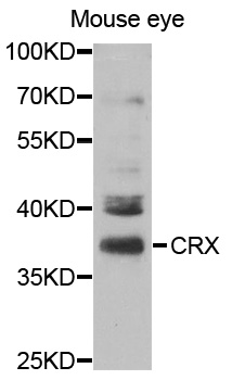 CRD / CRX Antibody - Western blot analysis of extracts of Mouse eye cells.