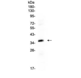 CRD / CRX Antibody - Western blot testing of human HepG2 cell lysate with CRX antibody at 0.5ug/ml. Predicted molecular weight ~32 kDa.