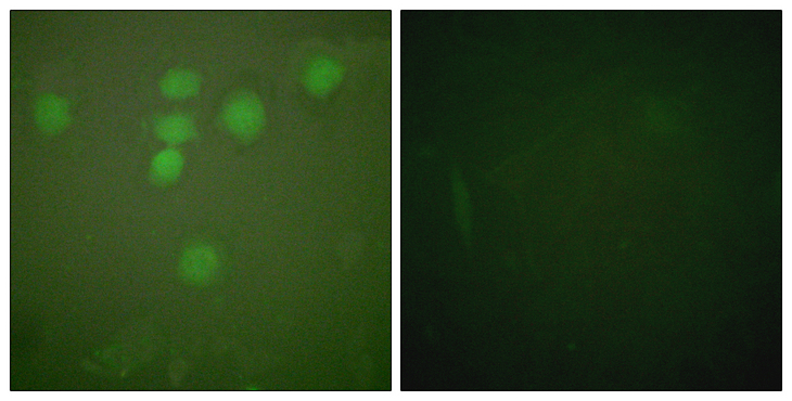 CREB1 / CREB Antibody - Immunofluorescence analysis of HeLa cells, using CREB Antibody. The picture on the right is blocked with the synthesized peptide.