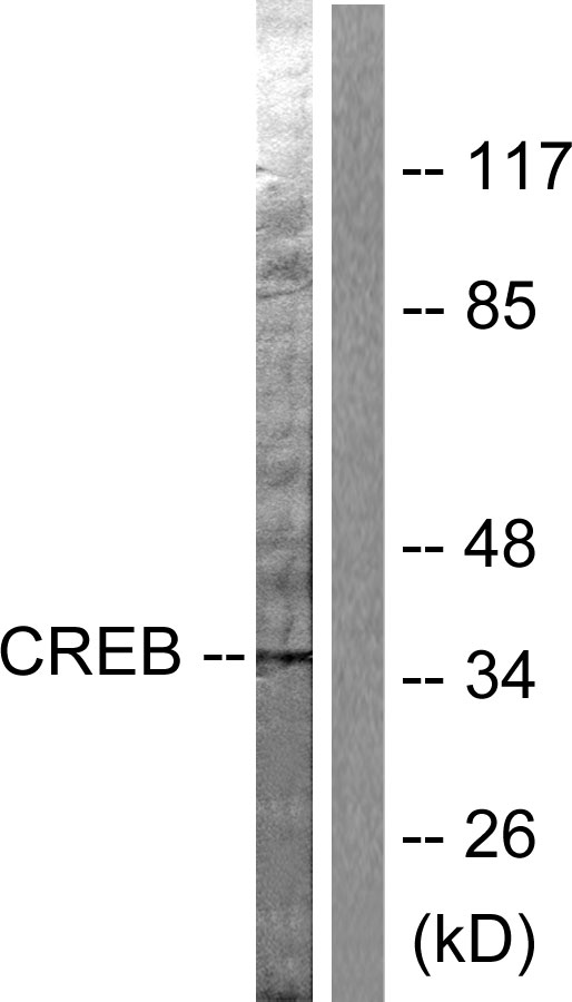 CREB1 / CREB Antibody - Western blot analysis of lysates from HeLa cells, treated with PMA 125ng/ml 30', using CREB Antibody. The lane on the right is blocked with the synthesized peptide.