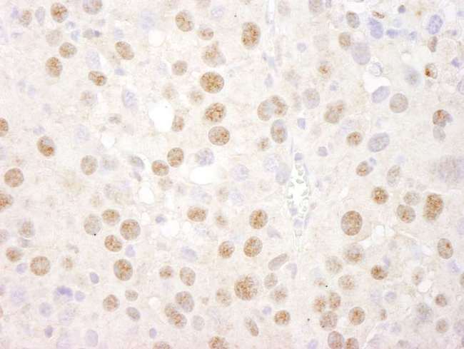 CREB1 / CREB Antibody - Detection of Mouse CREB by Immunohistochemistry. Sample: FFPE section of mouse renal cell carcinoma. Antibody: Affinity purified rabbit anti-CREB used at a dilution of 1:250.