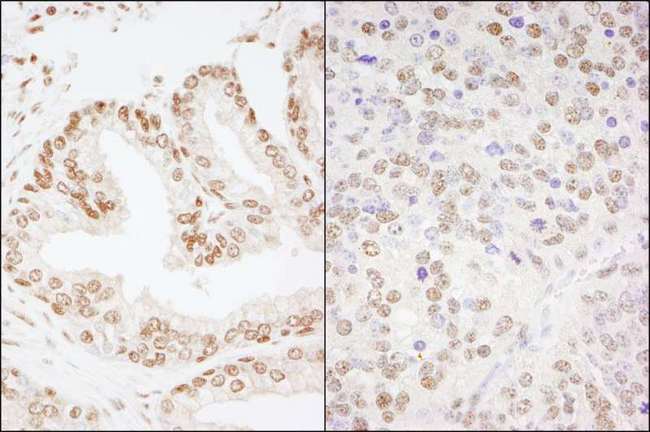 CREB1 / CREB Antibody - Detection of Human and Mouse CREB by Immunohistochemistry. Sample: FFPE section of human prostate carcinoma (left) and mouse teratoma (right). Antibody: Affinity purified rabbit anti-CREB used at a dilution of 1:200 (1 ug/ml). Detection: DAB.