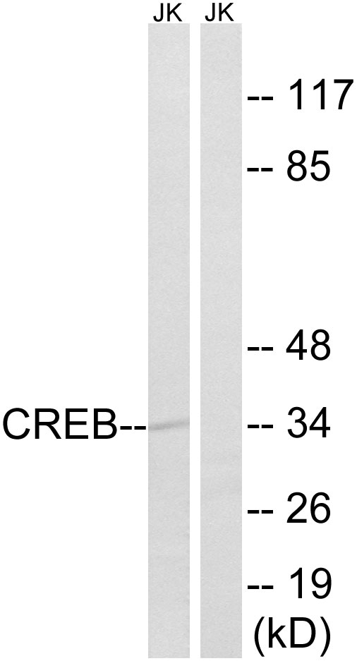 CREB1 / CREB Antibody - Western blot analysis of lysates from Jurkat cells, using CREB Antibody. The lane on the right is blocked with the synthesized peptide.