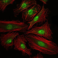 CREB1 / CREB Antibody - Immunofluorescence of HeLa cells using CREB1 mouse monoclonal antibody (green). Red: Actin filaments have been labeled with Alexa Fluor-555 phalloidin.