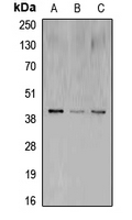 CREB1 / CREB Antibody - Western blot analysis of CREB expression in MCF7 (A); mouse brain (B); rat brain (C) whole cell lysates.