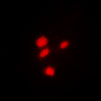 CREB1 / CREB Antibody - Immunofluorescent analysis of CREB staining in HeLa cells. Formalin-fixed cells were permeabilized with 0.1% Triton X-100 in TBS for 5-10 minutes and blocked with 3% BSA-PBS for 30 minutes at room temperature. Cells were probed with the primary antibody in 3% BSA-PBS and incubated overnight at 4 deg C in a humidified chamber. Cells were washed with PBST and incubated with a DyLight 594-conjugated secondary antibody (red) in PBS at room temperature in the dark. DAPI was used to stain the cell nuclei (blue).