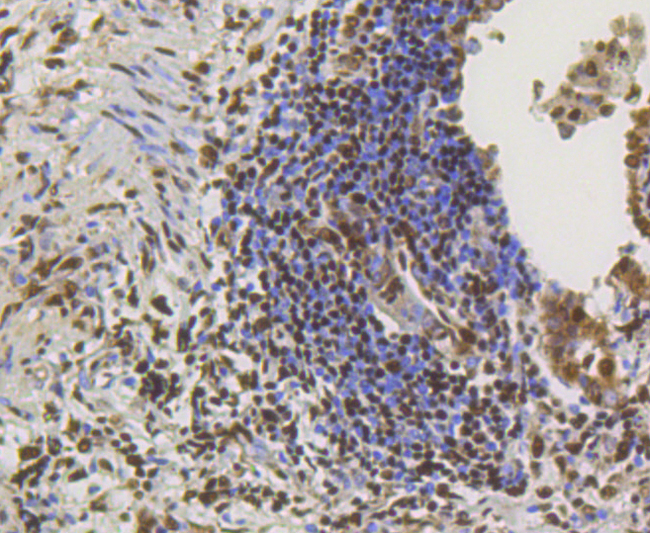 CREB1 / CREB Antibody - Immunohistochemistry of paraffin-embedded human lung using CREB1 antibodyat dilution of 1:100 (40x lens).