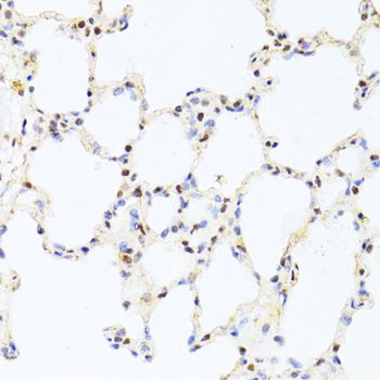 CREB1 / CREB Antibody - Immunohistochemistry of paraffin-embedded rat lung using CREB1 antibody at dilution of 1:100 (40x lens).