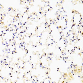 CREB1 / CREB Antibody - Immunohistochemistry of paraffin-embedded mouse lung using CREB1 antibody at dilution of 1:100 (40x lens).