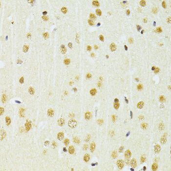 CREB1 / CREB Antibody - Immunohistochemistry of paraffin-embedded mouse brain using CREB1 antibody at dilution of 1:100 (40x lens).