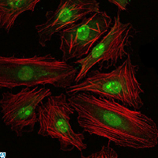 CREB1 / CREB Antibody - Immunofluorescence (IF) analysis of HeLa cells using CREB-1 Monoclonal Antibody (green). Red: Actin filaments have been labeled with Alexa Fluor-555 phalloidin.